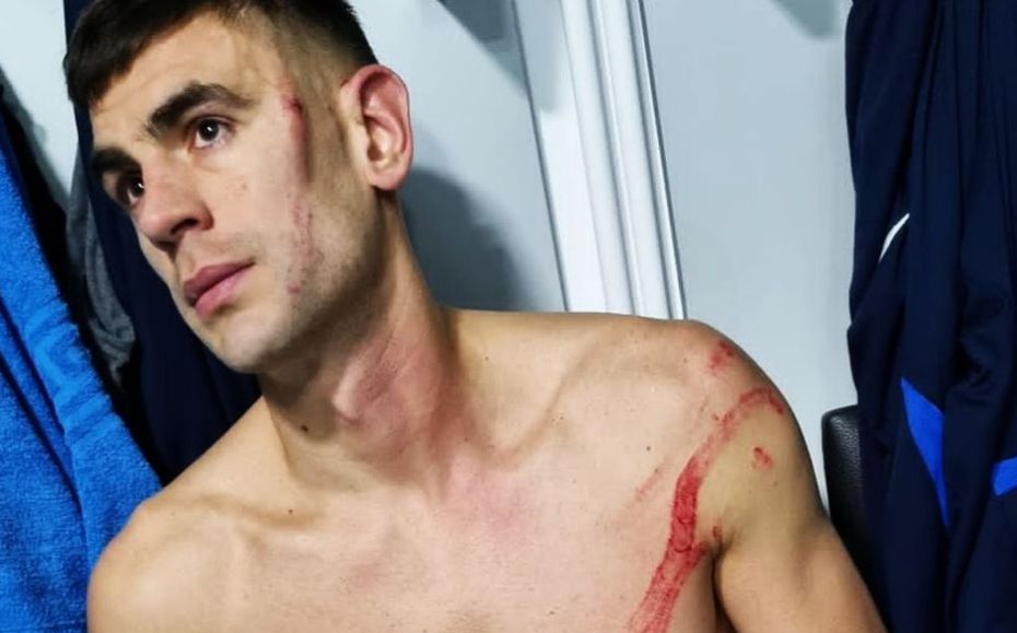 Edjouma, FAULT horror asupra lui Igor Armaş: „Putea să mă desfigureze!”. Jucătorul de la FCSB a scăpat de eliminare