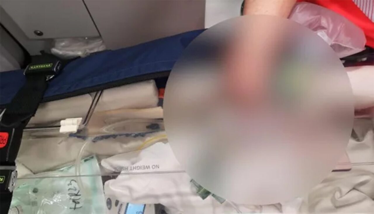 Caz IREAL în Maternitatea Botoșani! O graviduță de 19 ani a născut un bebeluș microsom