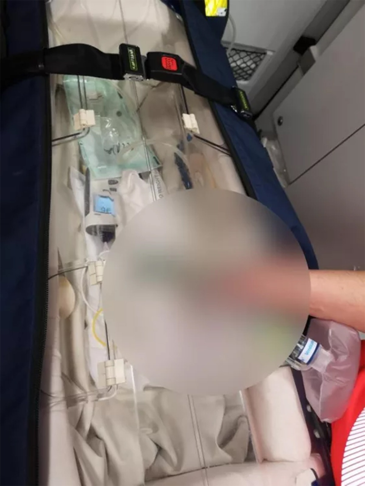 O graviduță de 19 ani a născut un bebeluș microsom / Sursa foto: Minitorul de Botoșani