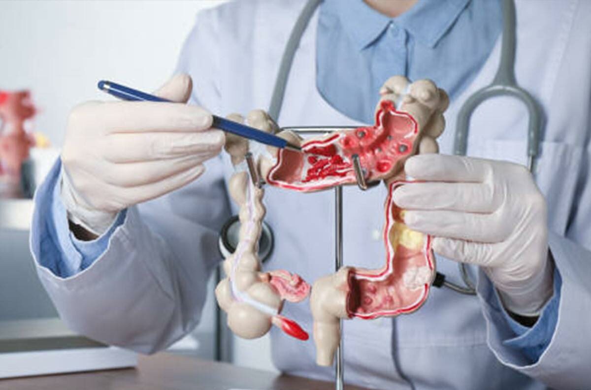 Programul de prevenție și depistare precoce, diagnostic și tratament  al leziunilor precanceroase colorectale la nivelul județului Ilfov continuă (P)