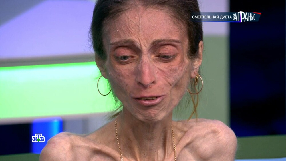 Cât mănâncă, de fapt, Iana, o tânără de 17 de kilograme. I s-a făcut RĂU în direct și a fost dusă la spital!