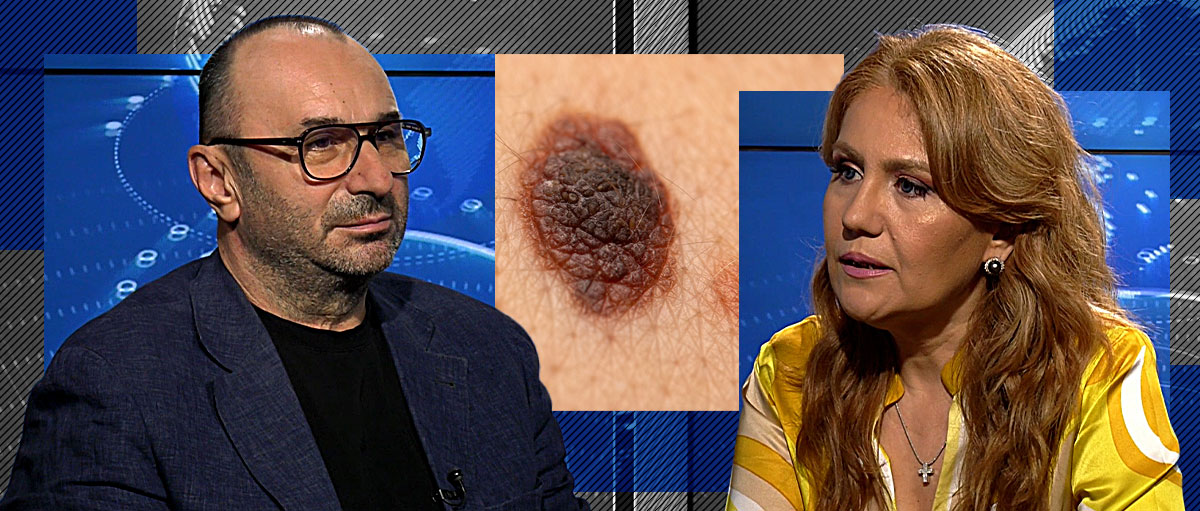 Prof. univ. dr. Olga Simionescu: „Melanomul este mult mai grav decât alte tipuri de cancer”