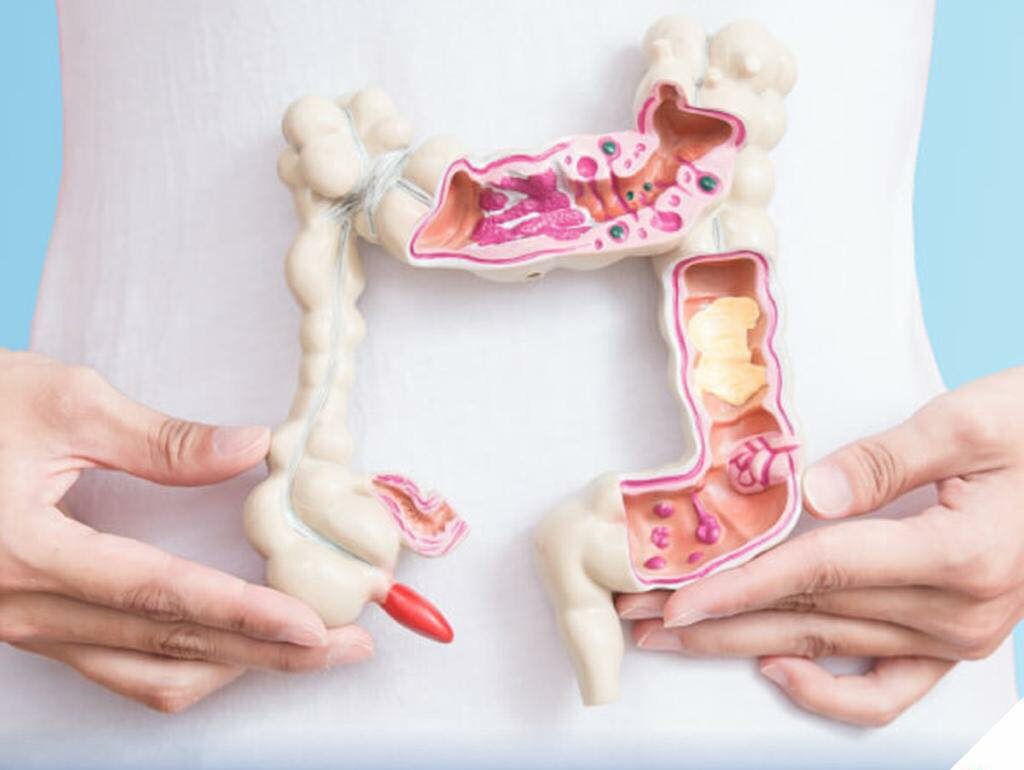 Programul de prevenție și depistarea precoce a leziunilor precanceroase colorectale în județul Ilfov continuă (P)