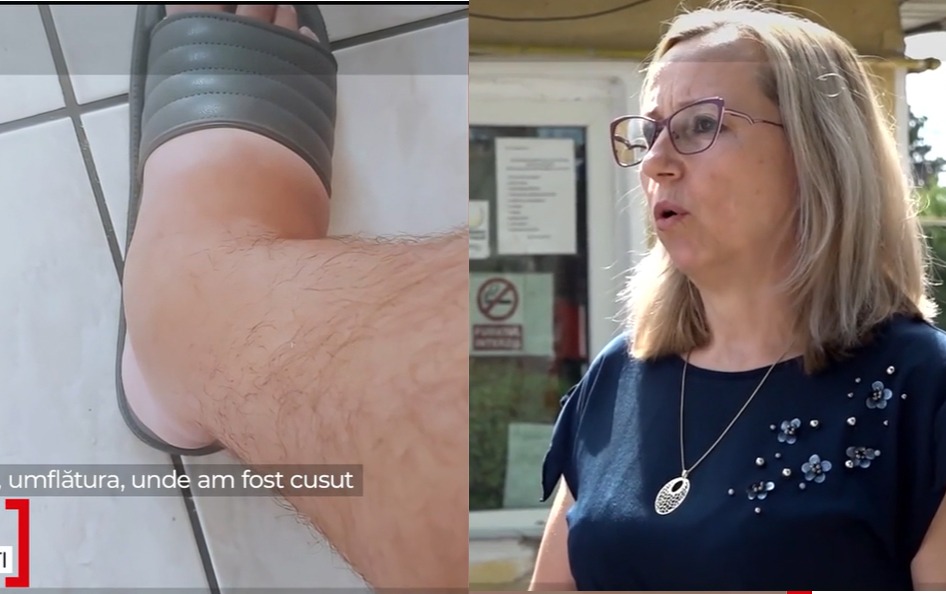 Ce spune tânărul căruia un medic de la Spitalul Urlați i-a ”uitat” frâna bicicletei în picior: ”M-au tăiat. Am rămas şocaţi toţi”