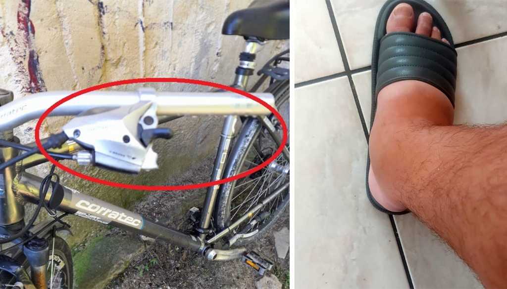 Ce mesaj i-a dat medicul spitalului din Urlați pacientului căruia i-a cusut în picior mânerul de la frâna de mână a unei biciclete