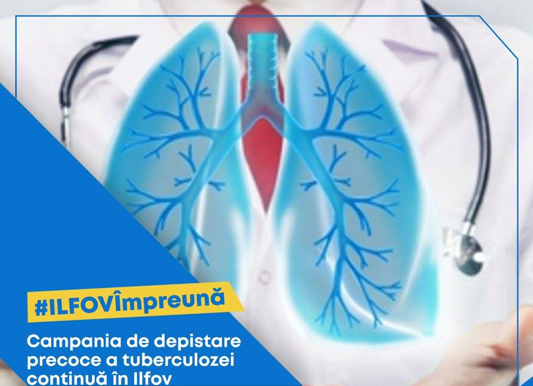 Campania de depistare precoce a tuberculozei, din Ilfov, continuă în Jilava, Domnești și Clinceni (P)