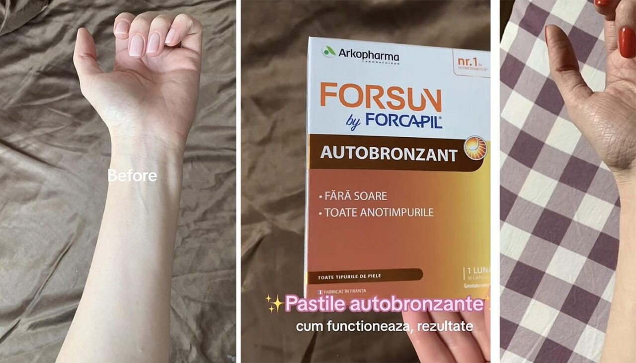 Ce a pățit o tânără din IAȘI, după ce a luat pastile autobronzante. Cum arată pielea ei acum