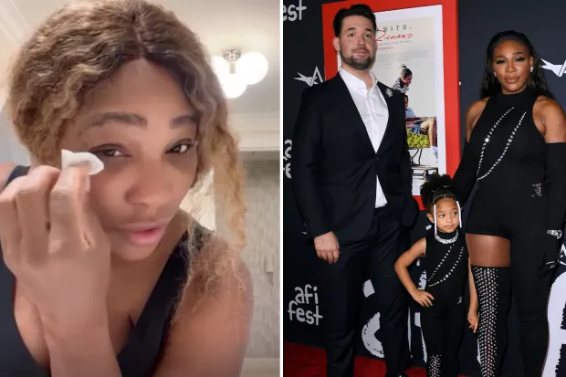 Fanii Serenei Williams, îngroziți. Sportiva a dezvăluit modul „CIUDAT” în care își tratează arsurile solare: „La mine și la copiii mei funcționează”