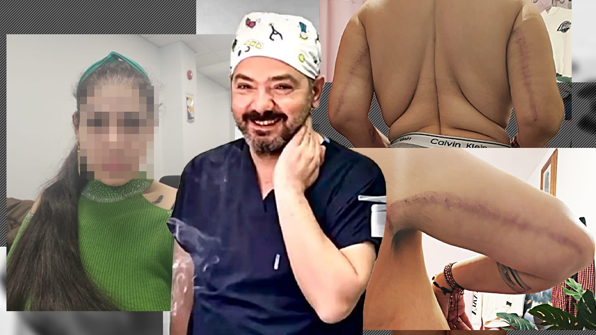 Caz la indigo cu cel al Ralucăi Ciupitu, românca MOARTĂ după ce s-a operat în Turcia. „M-au mutilat, m-au cusut ca pe un porc”