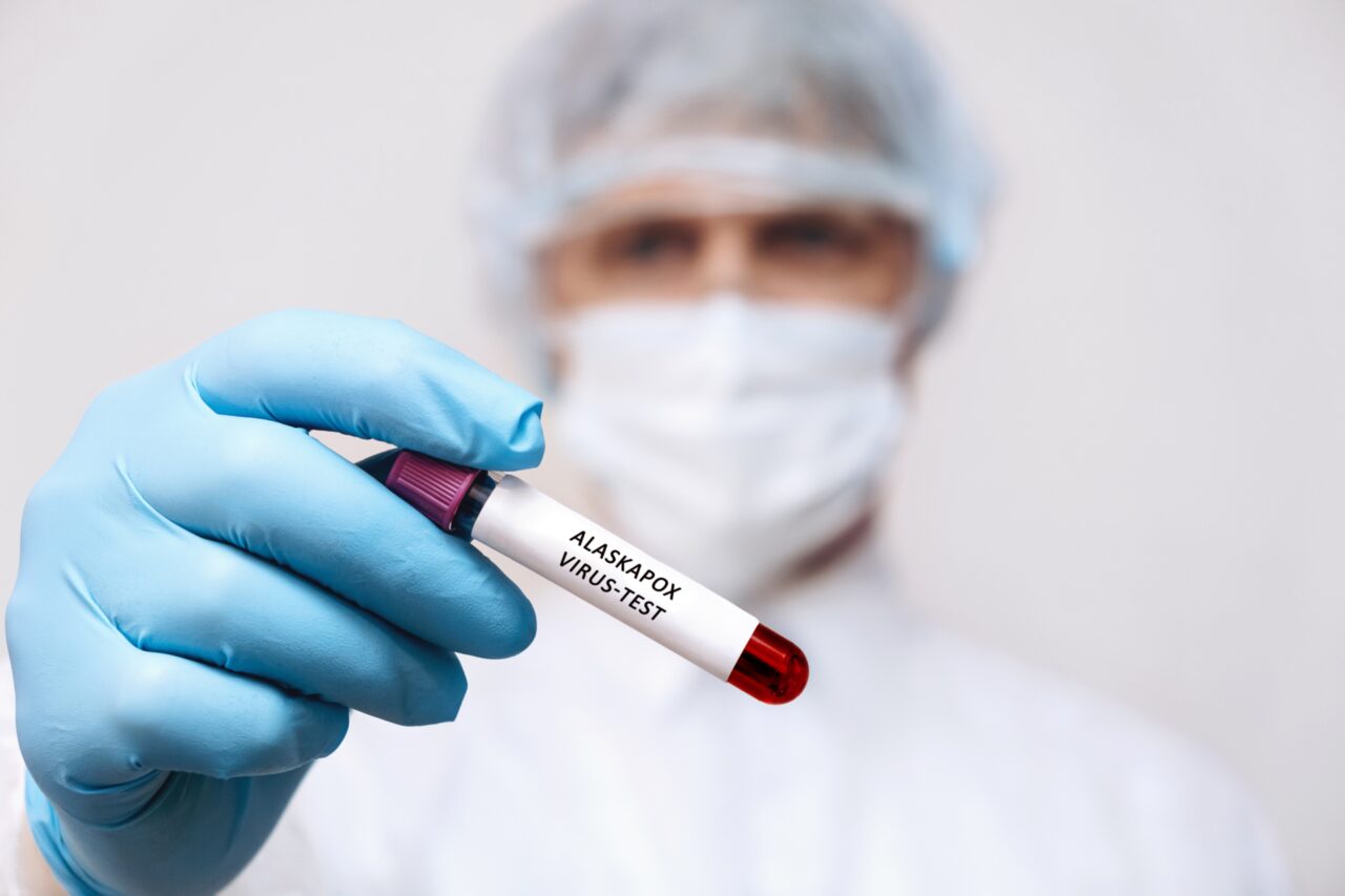 Un bărbat a murit după ce s-a infectat cu un nou VIRUS, descoperit recent în Alaska. Specialiștii spun că este înrudit cu cel care provoacă variola