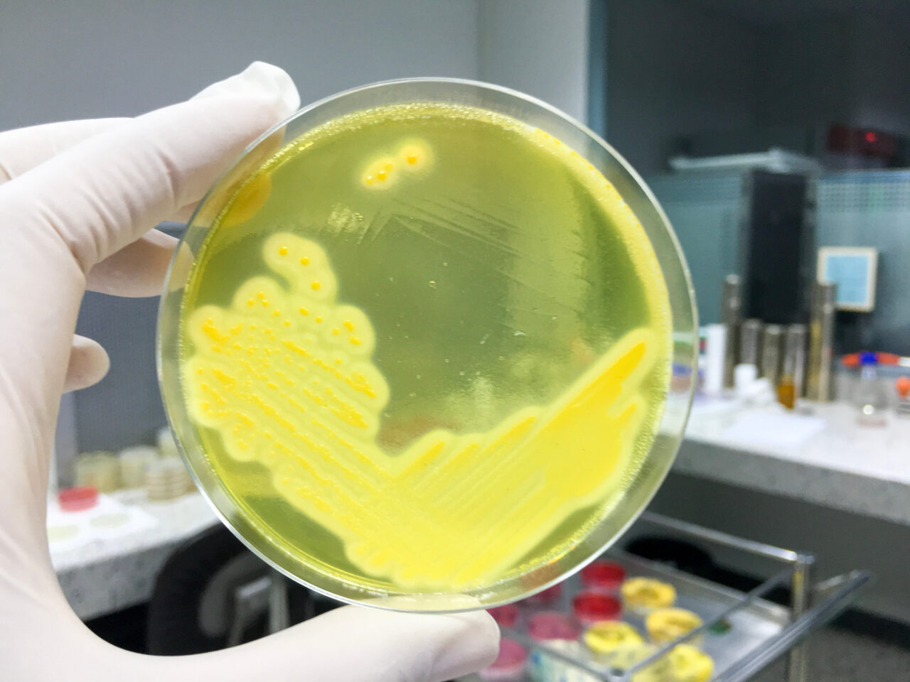 O BOALĂ contagioasă se răspândește în Japonia. Rata mortalității ajunge la 30%!