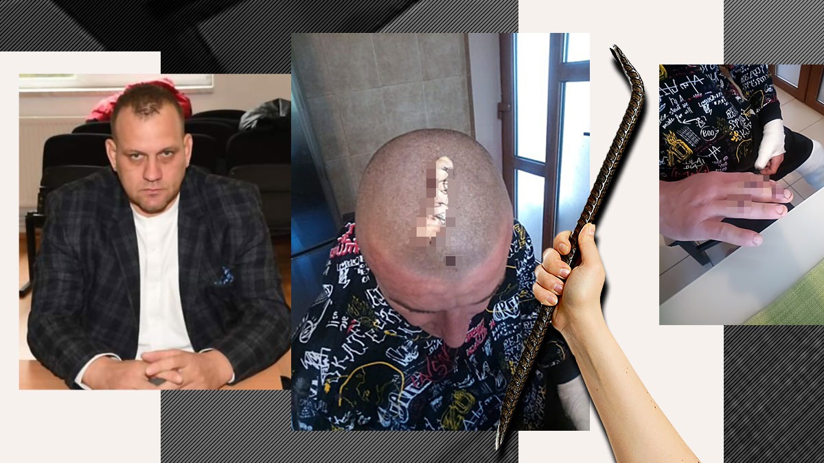 Un bărbat a fost cusut și băgat în ghips, după ce a fost BĂTUT cu ranga de un politician din Dâmbovița