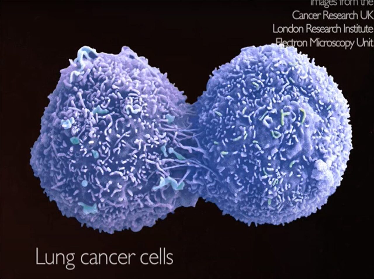 Tratamentul împotriva CANCERULUI a fost descoperit. Cum au reușit cercetătorii acest lucru