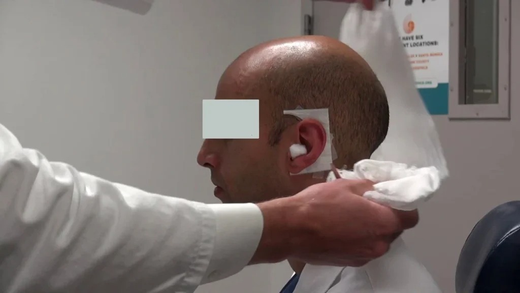 Scandal șocant la Iași. Un bărbat a ajuns la spital cu URECHEA ruptă și mestecată după un conflict cu un „amic de pahar”