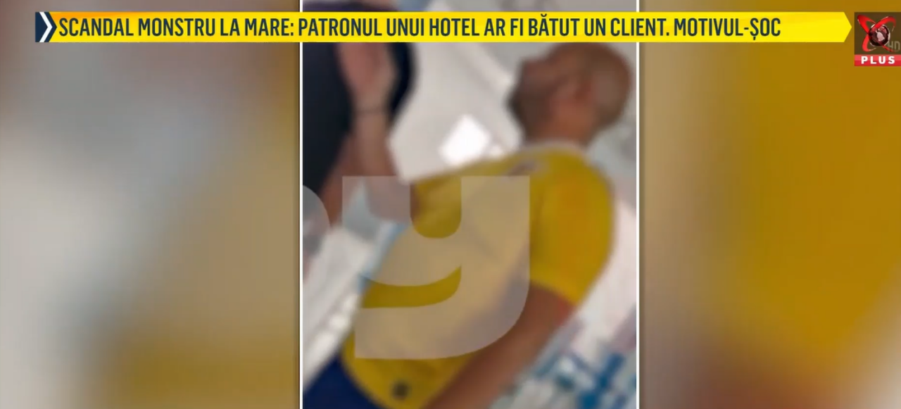 Scene VIOLENTE pe litoralul românesc. Patronul unui hotel ar fi bătut un client, ce ar fi solicitat să i se aducă un alt fel de mâncare
