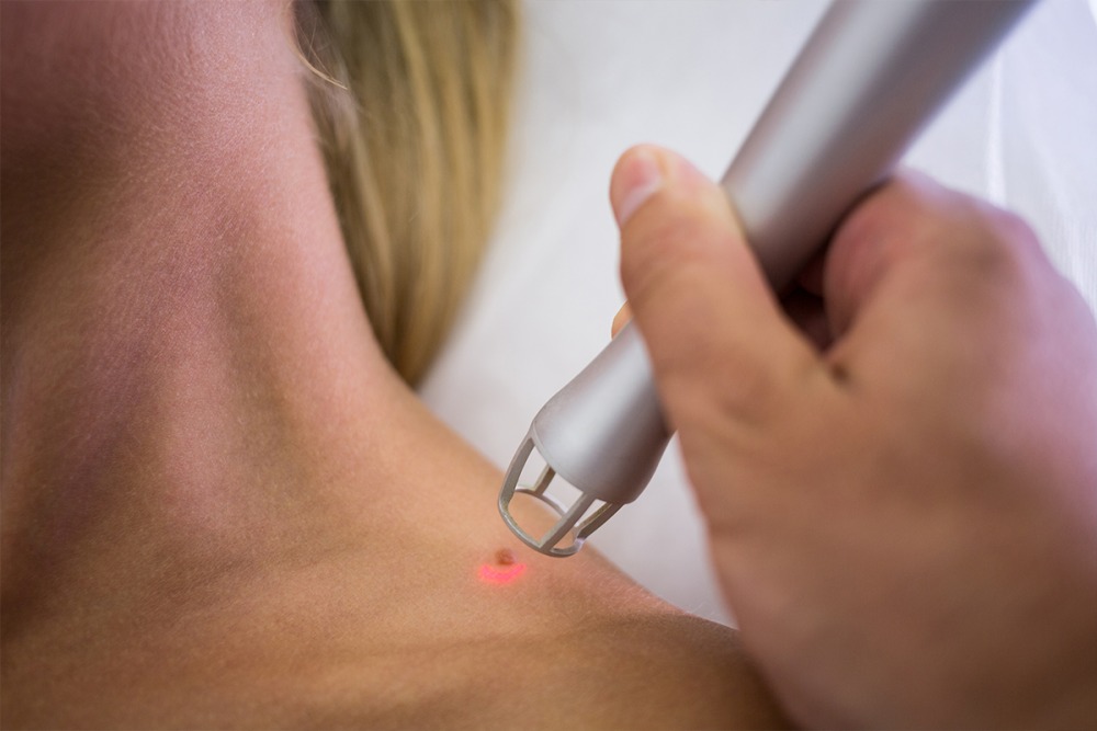 Care sunt afecțiunile pe care le poți evalua mergând la un cabinet de dermatologie din Suceava (P)