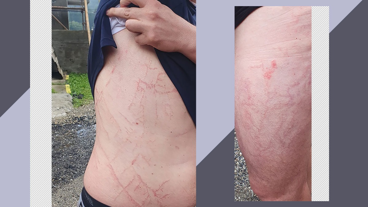 Un turist a fost lovit de FULGER, în Munții Făgăraș, și a supraviețuit. După ce a fost inconștient 30 de minute, bărbatul a coborât singur de pe munte