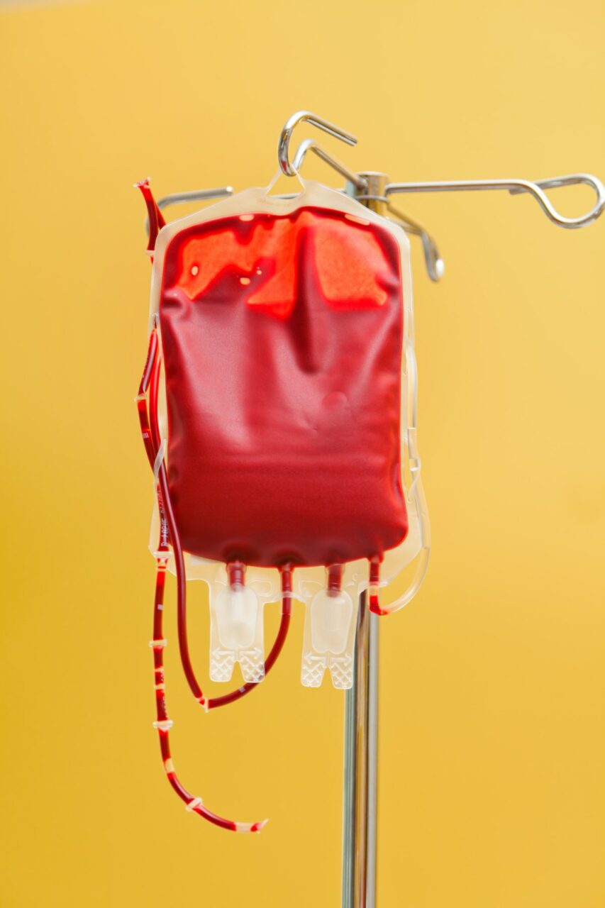 Zece miliarde de lire, compensații pe viață pentru victimele unor transfuzii cu sânge infectat cu HIV