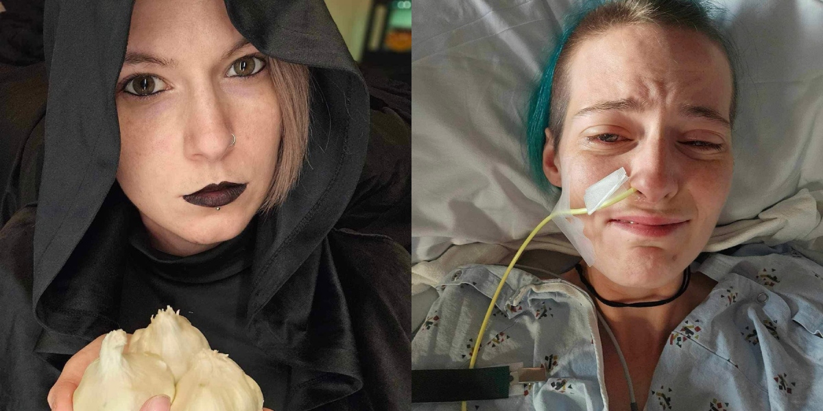Tânăra care suferă de „boala vampirului”. Afecțiunea îi poate fi FATALĂ