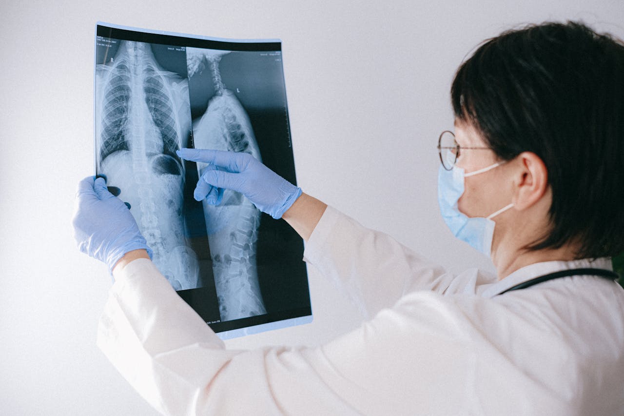 Testul rapid care depistează dacă ai risc de CANCER pulmonar. Cum funcționează