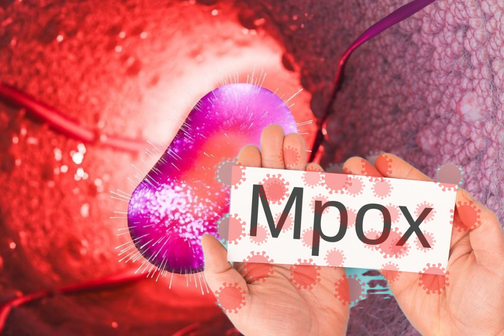Epidemia care amenință omenirea. Noua variantă a virusului MPOX se transmite în principal de la om la om