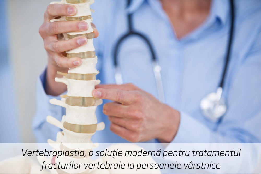 Vertebroplastia, o soluție modernă pentru tratamentul fracturilor vertebrale la persoanele vârstnice