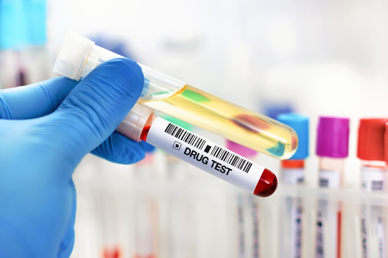 Înalta Curte a decis că sunt necesare EXPERTIZE pentru a stabili dacă substanțele psihoactive găsite în organsimul unui șofer îl afectează la condus