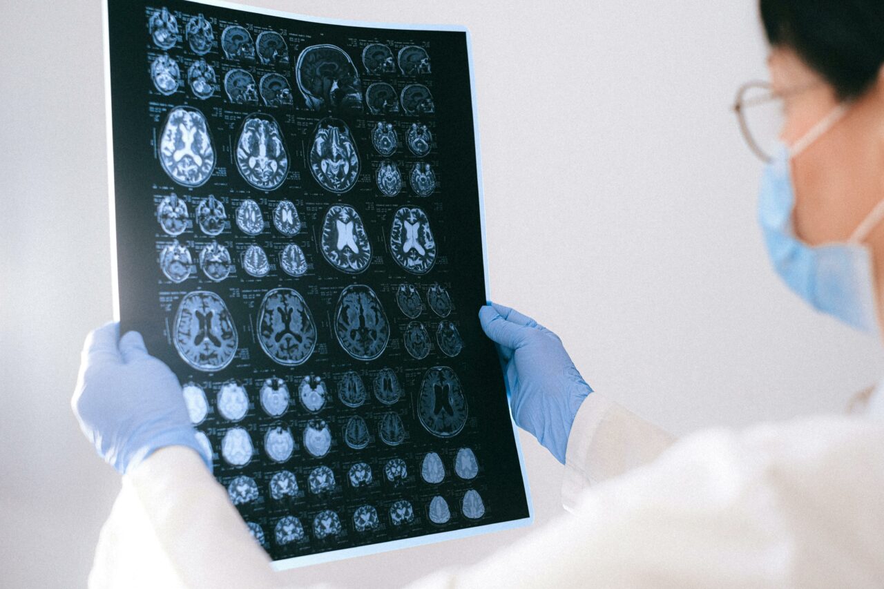 Sute de copii cu epilepsie, uitați de statul român