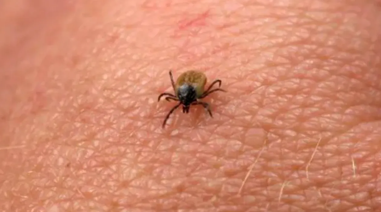 Cum scapi de CĂPUȘE dacă stai la curte. Acest truc va ține la distanță insectele