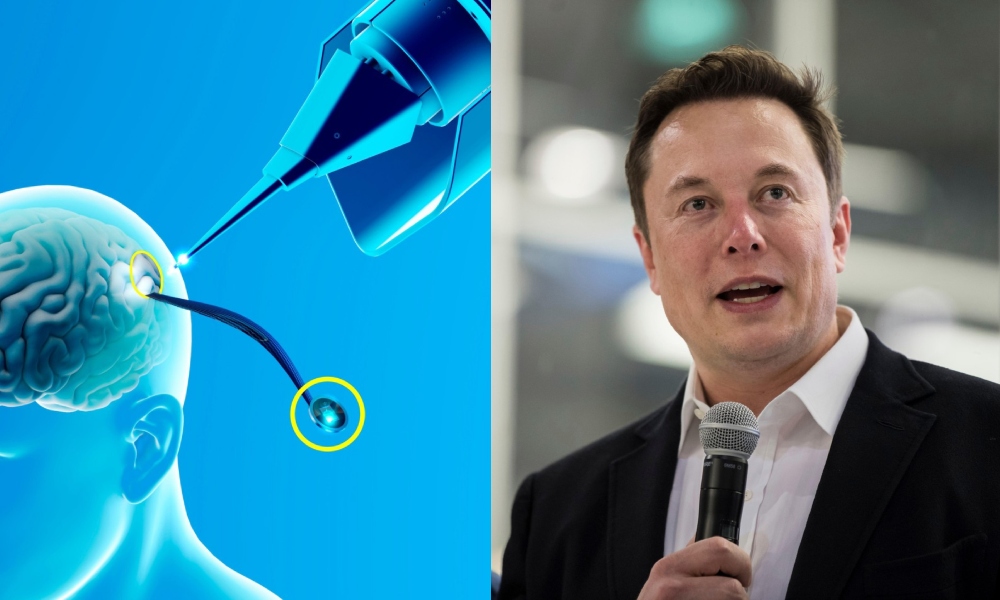 O femeie, paralizată complet, a reușit să-și SCRIE numele cu ajutorul tehnologiei Neuralink. Elon Musk: „Controlează computerul cu puterea minții”