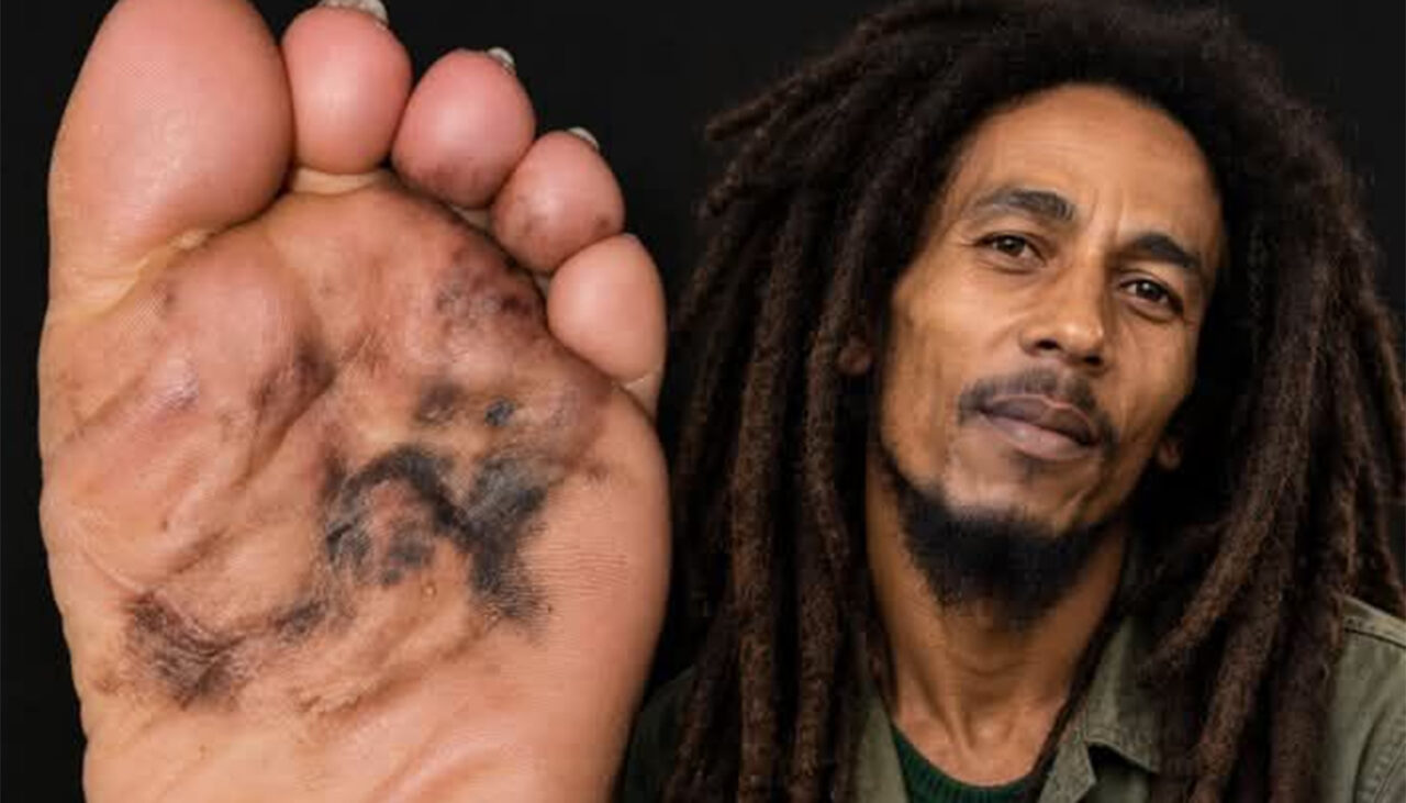 În 1977, Bob Marley a observat o zonă întunecată pe degetul mare de la piciorul drept. Juca fotbal și a crezut că s-a lovit. Când, în cele din urmă, a fost examinată, diagnosticul a fost crunt. 4 ani mai târziu, a murit